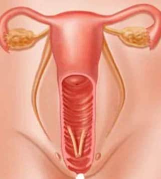 Causas da infertilidade feminina